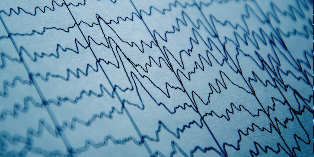 Sleep Stages: A Guide to Understanding Your Sleep Cycle